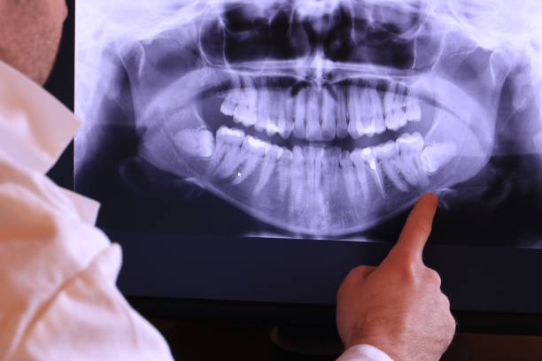 Best Emergency Treatment for Dental Infections or Abscesses in Orono, MN